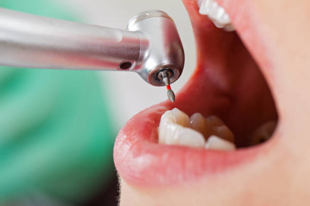 Best Emergency Cosmetic Dentistry in Pittsville, MD